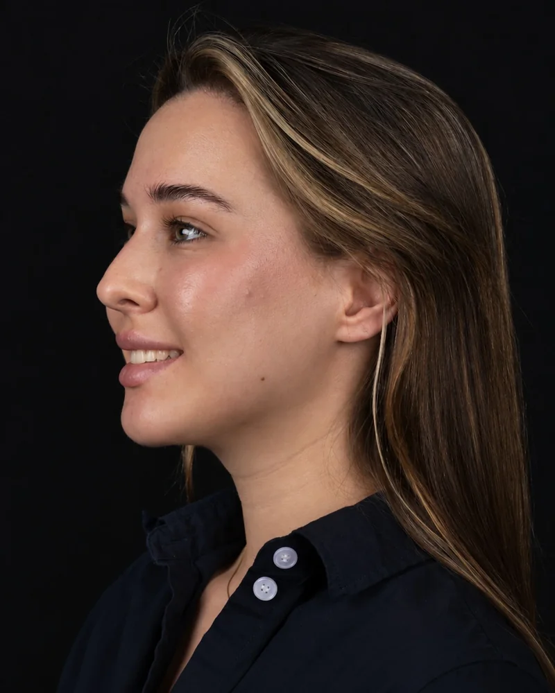 Left Profile · Smile