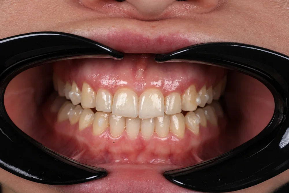 Intraoral Detail · Occlusion